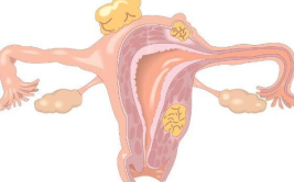 女性排尿困难,病因、症状与应对策略
