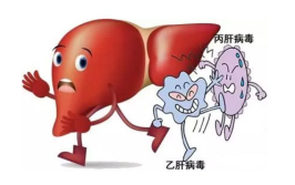乙肝能治好吗,从控制到治愈的希望之路